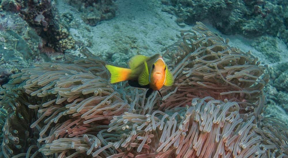 Global Residence - View 26